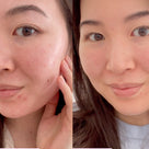 Australian Glow Berries Super Bounce Mask Thumb 1