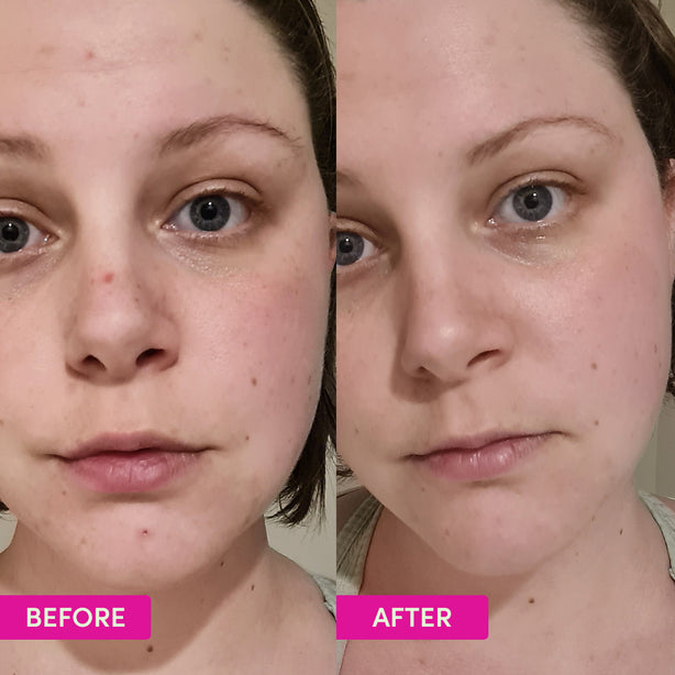 Australian Glow Berries Intense Glow Moisturiser