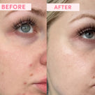 Australian Pink Clay Resurfacing Mask Thumb 1